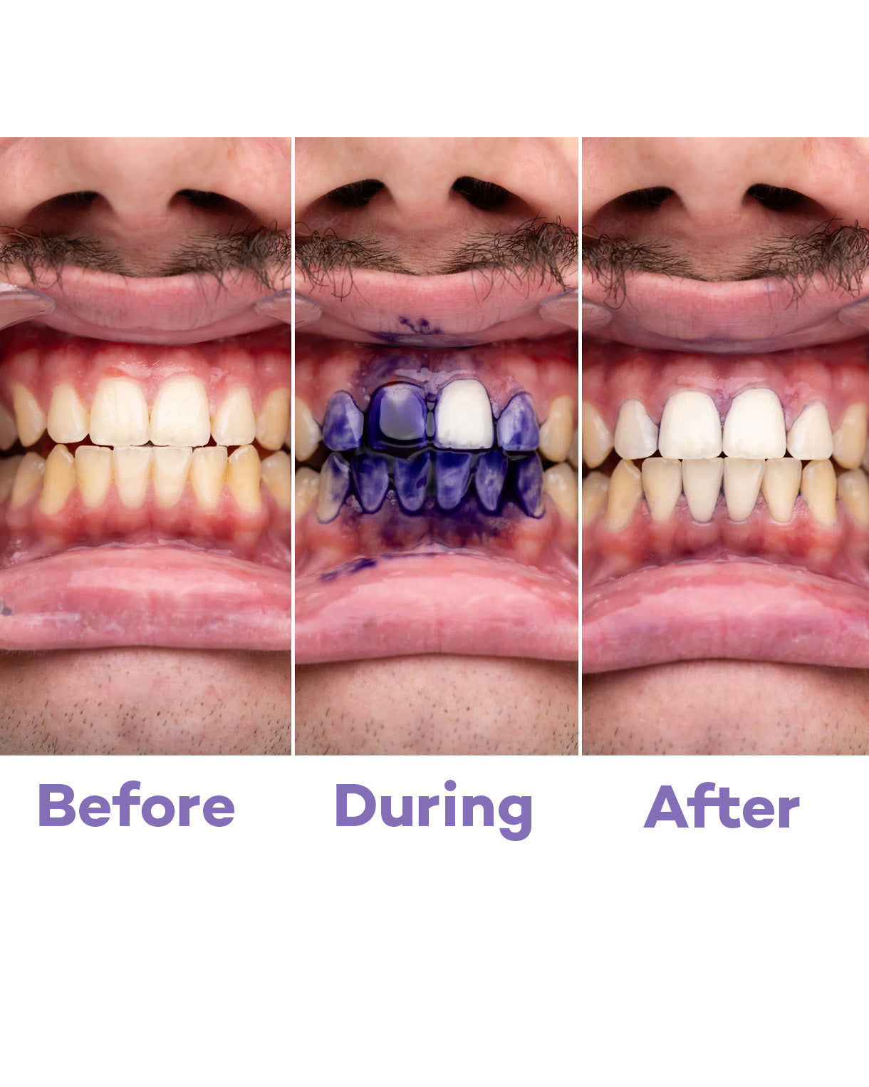 Whitening Foam PV34 (Einführungsangebot)